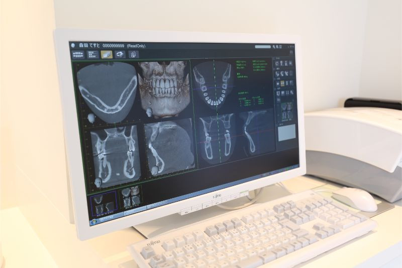 歯科用3D-CT機器