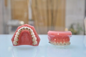 白い歯を見せる子供達